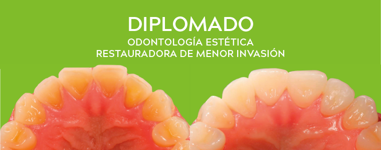 Diplomado Odontología Estética Restauradora de Menor Invasión