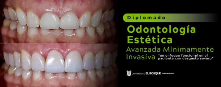 Diplomado Odontología Estética Avanzada Mínimamente Invasiva