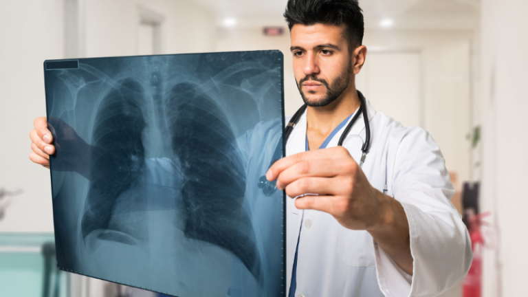 nodulos-pulmonares-cancer-estudio-universidad-elbosque