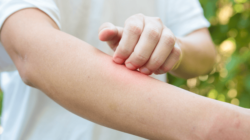 vacunacion-fiebre-amarilla-colombia-prevencion