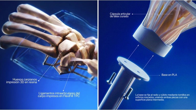 Huesos impresos en 3D en resina y cápsula articular del simulador de cirugía de mano, con su base de fijación