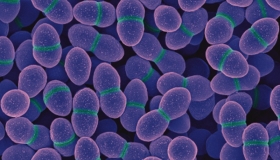 Socialización de avances de trabajo de grado - Maestría en Odontología